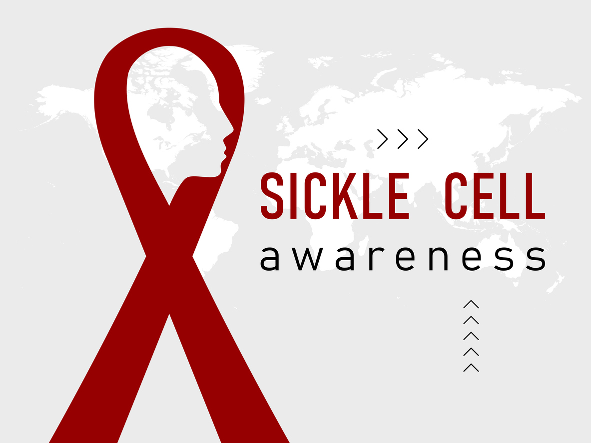 FDA Greenlights Groundbreaking Gene Therapies for Sickle Cell Disease. Red Ribbon Sickle Cell Awareness